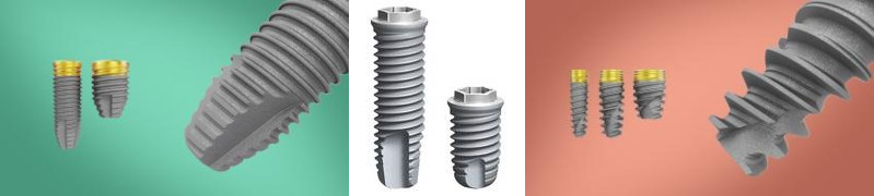 Kurze Dentalimplantate
Bildquelle: ©Nobel Biocare Services AG
 