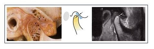 Anatomische und radiologische Ansicht des Kiefergelenks. Anatomische und radiologische Ansicht des Kiefergelenks.