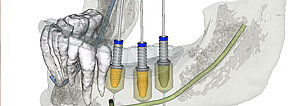 Digitale Zahnmedizin Digitale Zahnmedizin